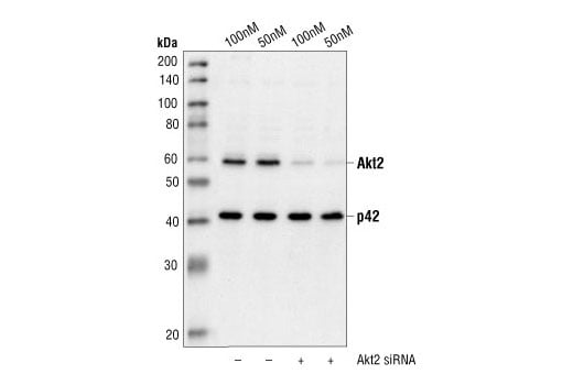 undefined Image 2: SignalSilence<sup>®</sup> Akt2 siRNA