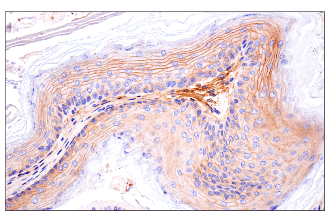 Immunohistochemistry Image 9: CD81 (D5O2Q) Rabbit Monoclonal Antibody