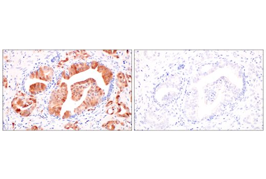 Immunohistochemistry Image 10: p16 INK4A (BC42) Mouse Monoclonal Antibody