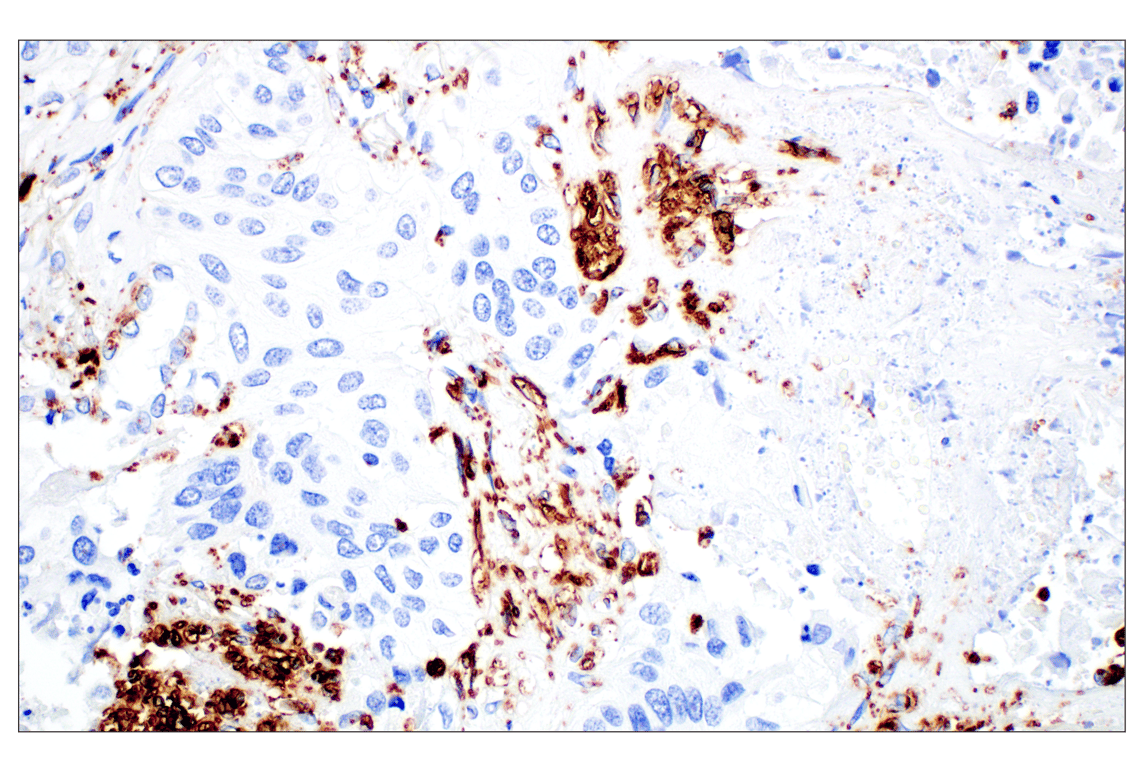Immunohistochemistry Image 2: Perilipin-2 (E6G6M) Rabbit Monoclonal Antibody