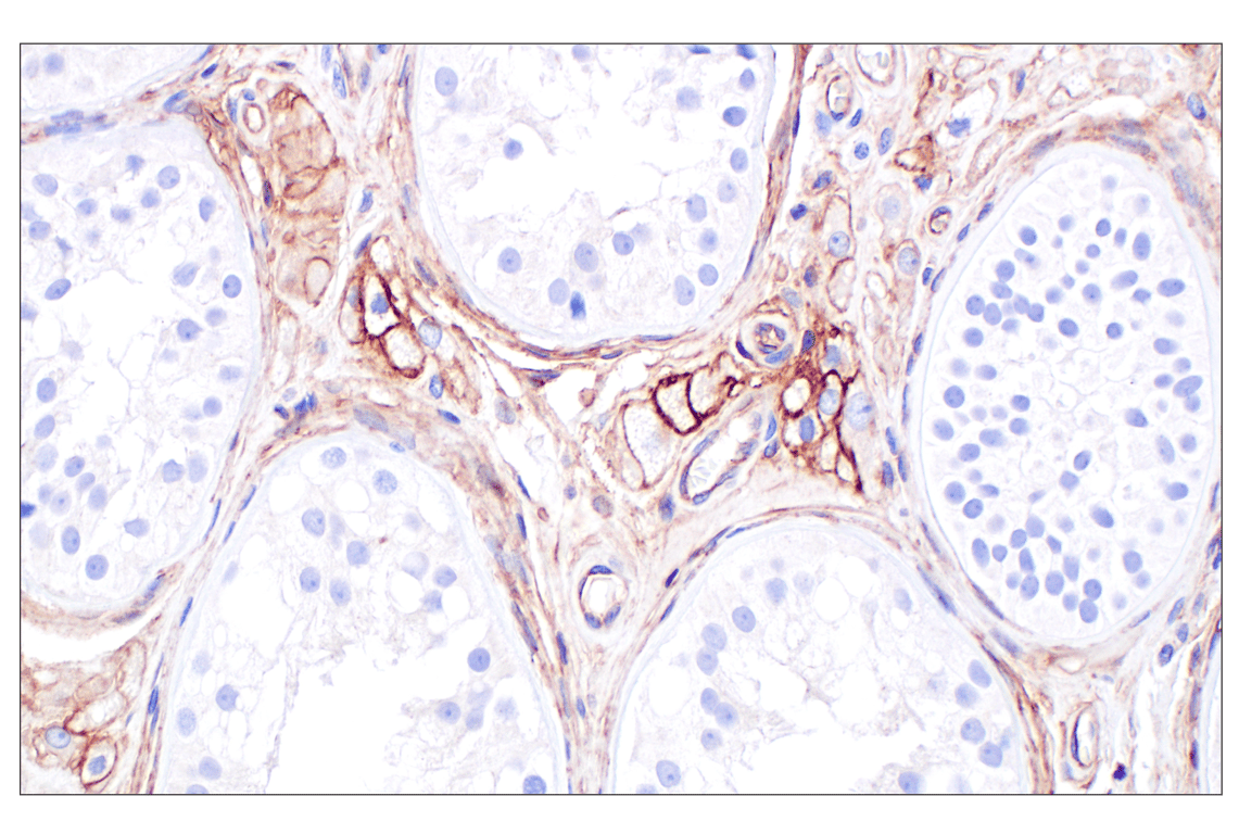 Immunohistochemistry Image 5: CD105/Endoglin (F9C5Q) Rabbit Monoclonal Antibody (BSA and Azide Free)