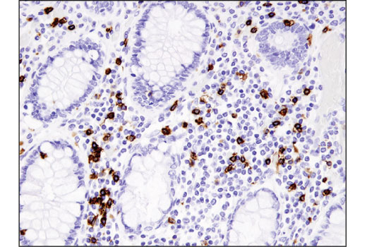 Immunohistochemistry Image 1: CD8 alpha (D8A8Y) Rabbit Monoclonal Antibody