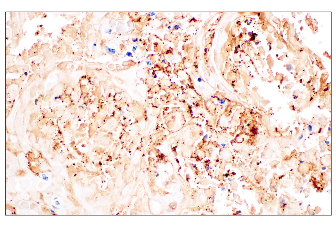 Immunohistochemistry Image 5: Citrullinated Histone H3 (Arg2) (F3C9B) Rabbit mAb (IHC Formulated)