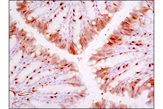 Immunohistochemistry Image 2: Phospho-NDRG1 (Thr346) (D98G11) Rabbit Monoclonal Antibody