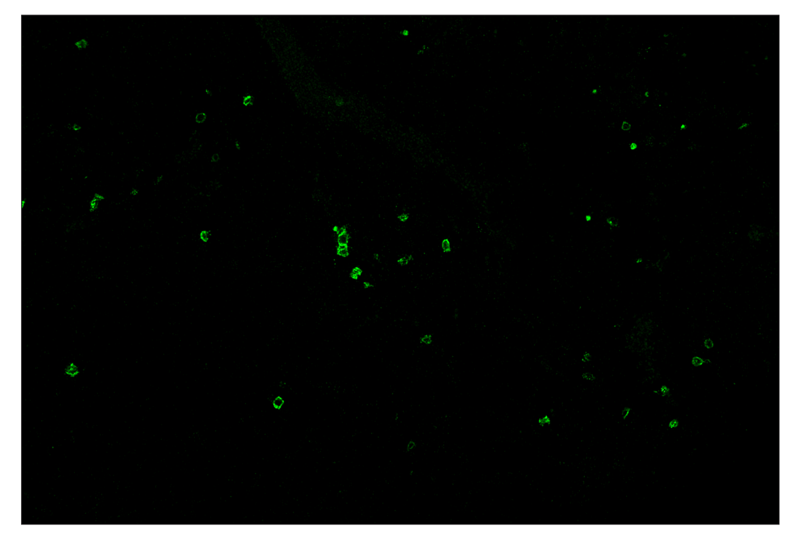 Immunohistochemistry Image 2: CD8 alpha (D4W2Z) & CO-0040-594 SignalStar<sup>™</sup> Oligo-Antibody Pair