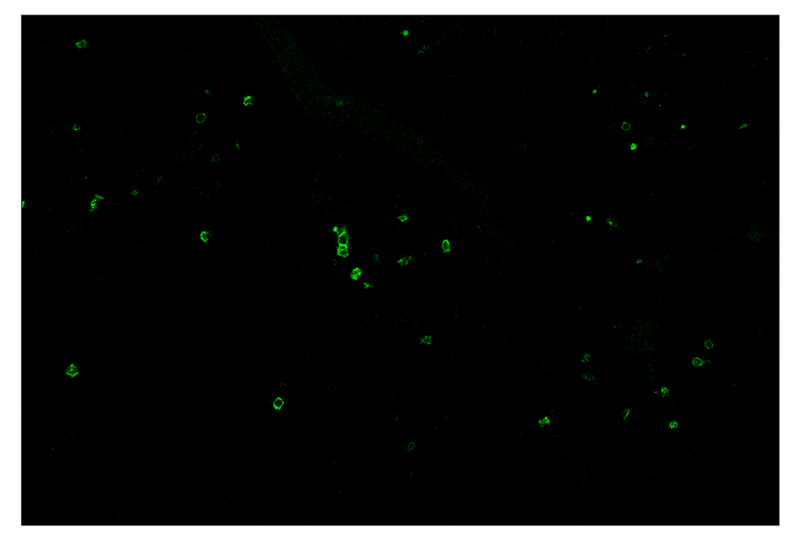 Immunohistochemistry Image 2: CD8α (D4W2Z) & CO-0040-647 SignalStar<sup>™</sup> Oligo-Antibody Pair