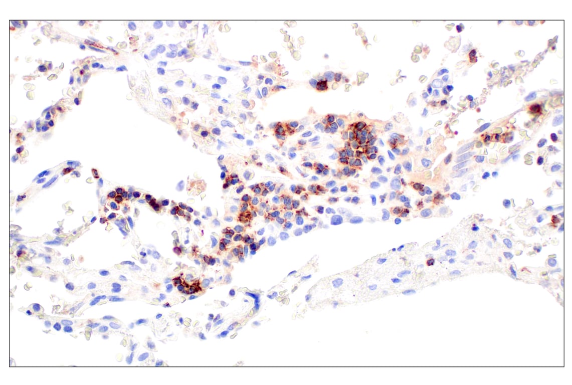 Immunohistochemistry Image 2: CD62L/L-Selectin (E7X9I) Rabbit Monoclonal Antibody
