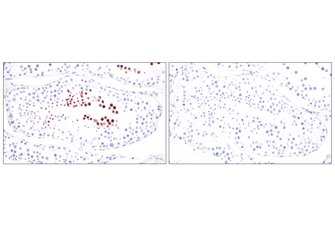 Immunohistochemistry Image 8: FOXG1 (E2W8P) Rabbit Monoclonal Antibody