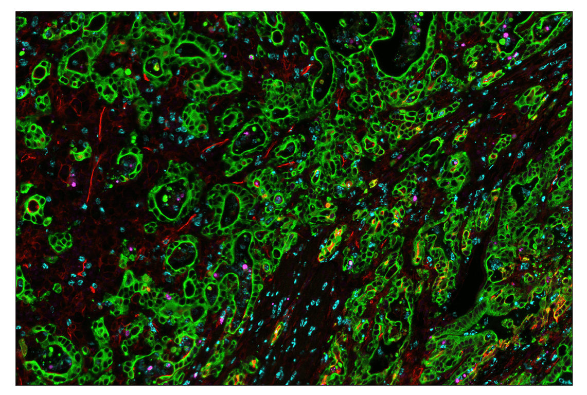 Immunohistochemistry Image 1: CD54/ICAM-1 (E3Q9N) & CO-0146-594 SignalStar<sup>™</sup> Oligo-Antibody Pair