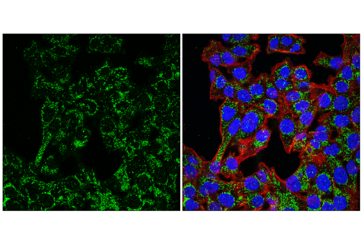 Immunofluorescence Image 1: MCU (D2Z3B) Rabbit Monoclonal Antibody