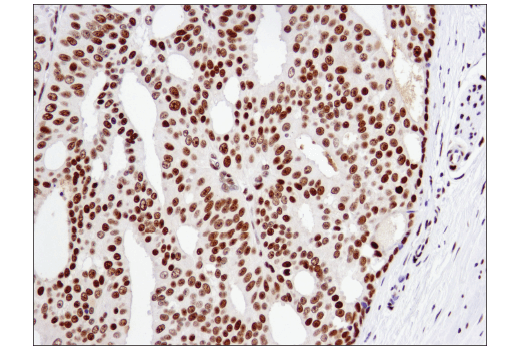 Immunohistochemistry Image 5: ATF-2 (D4L2X) Rabbit Monoclonal Antibody
