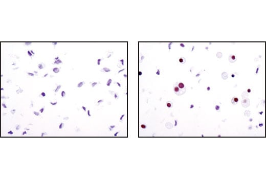 Immunohistochemistry Image 1: PPAR gamma (C26H12) Rabbit Monoclonal Antibody