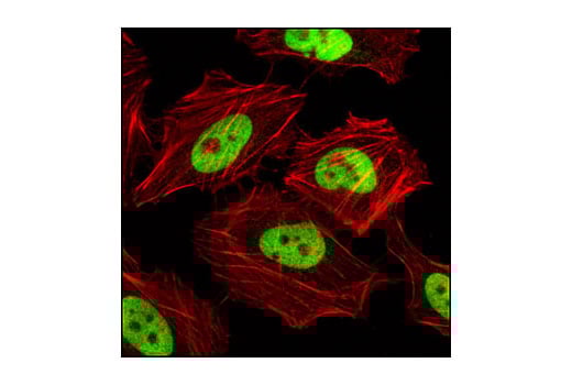 Immunofluorescence Image 1: CTCF Antibody