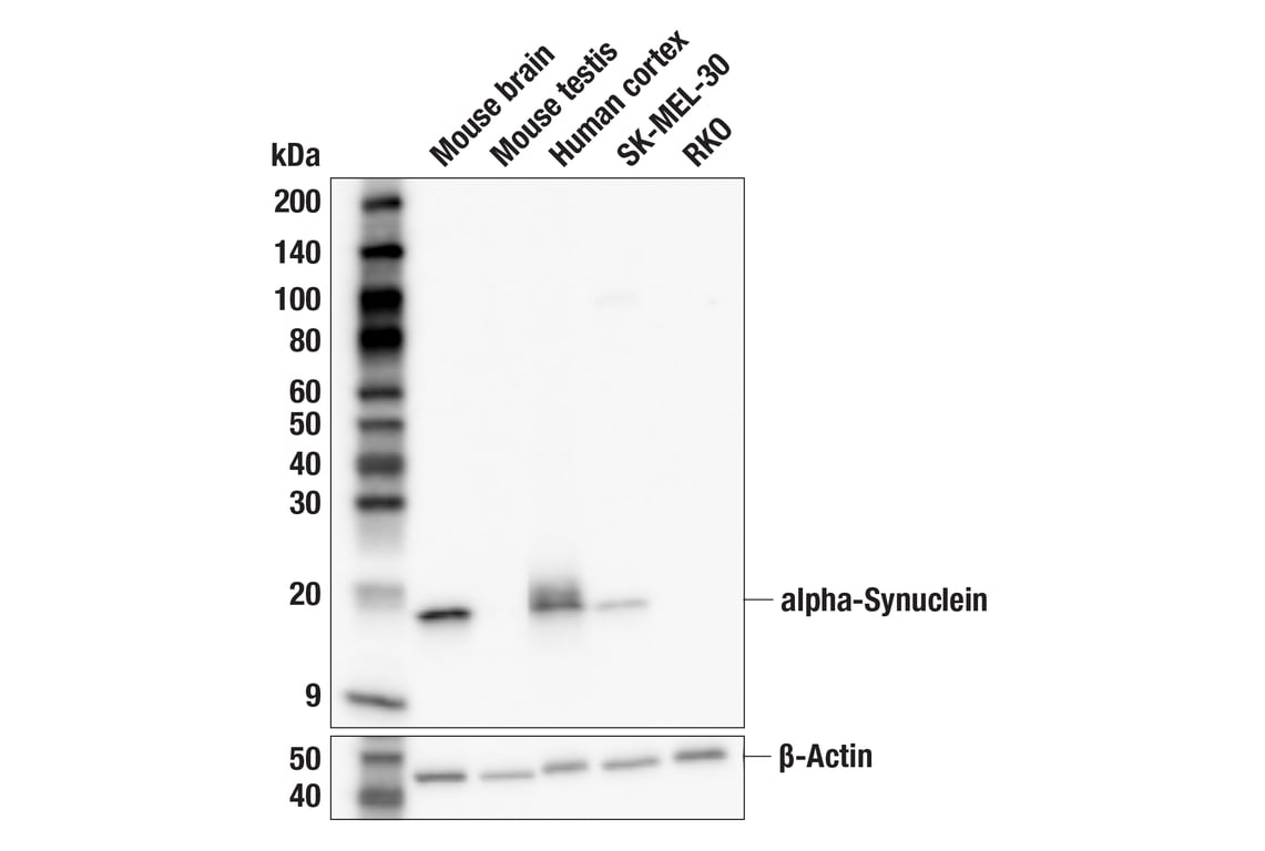 あこページ TDP43 (D9R3L) Rabbit Monoclonal Antibody | Cell Signaling Technology
