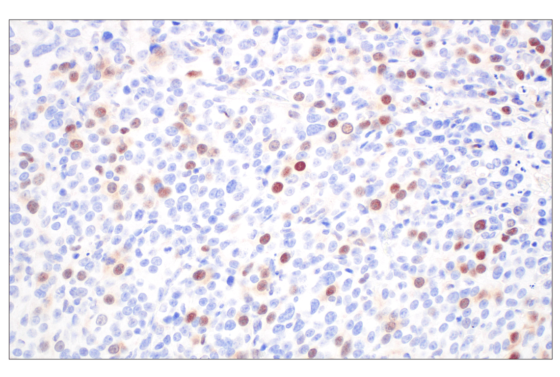 Immunohistochemistry Image 2: Cyclin A2 (E9Q5G) Rabbit mAb (BSA and Azide Free)