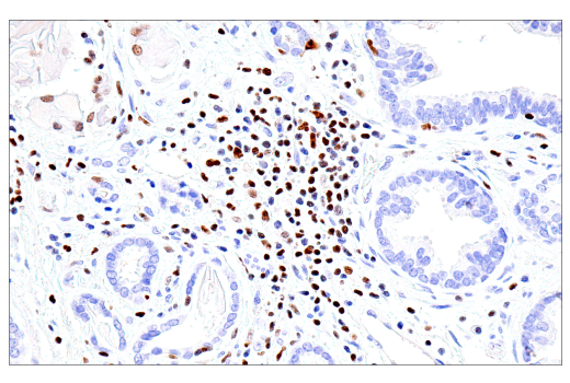 Immunohistochemistry Image 3: RUNX3/AML2 (E8D5W) Rabbit Monoclonal Antibody