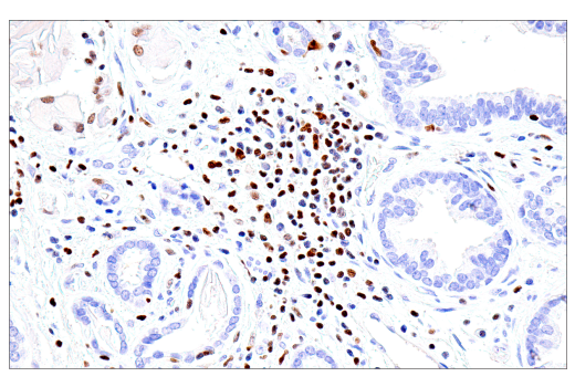 Immunohistochemistry Image 3: RUNX3/AML2 (E8D5W) XP<sup>®</sup> Rabbit mAb