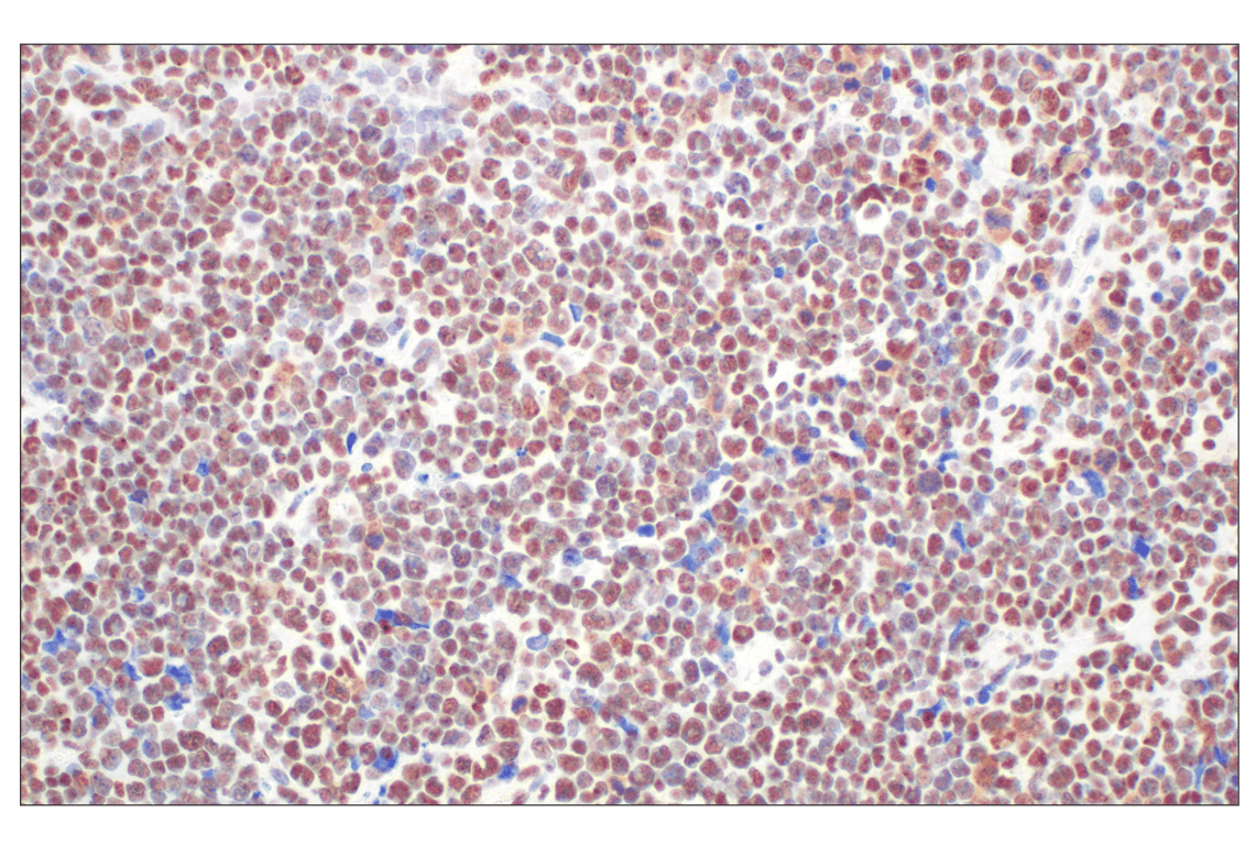 Immunohistochemistry Image 8: CBX7 (E7N1W) Rabbit Monoclonal Antibody