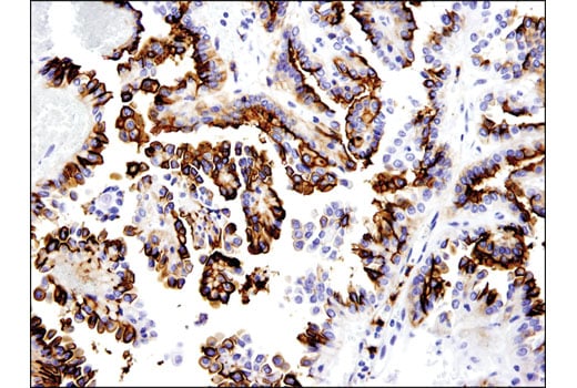 Immunohistochemistry Image 3: OLFM4 (D1E4M) Rabbit Monoclonal Antibody (BSA and Azide Free)