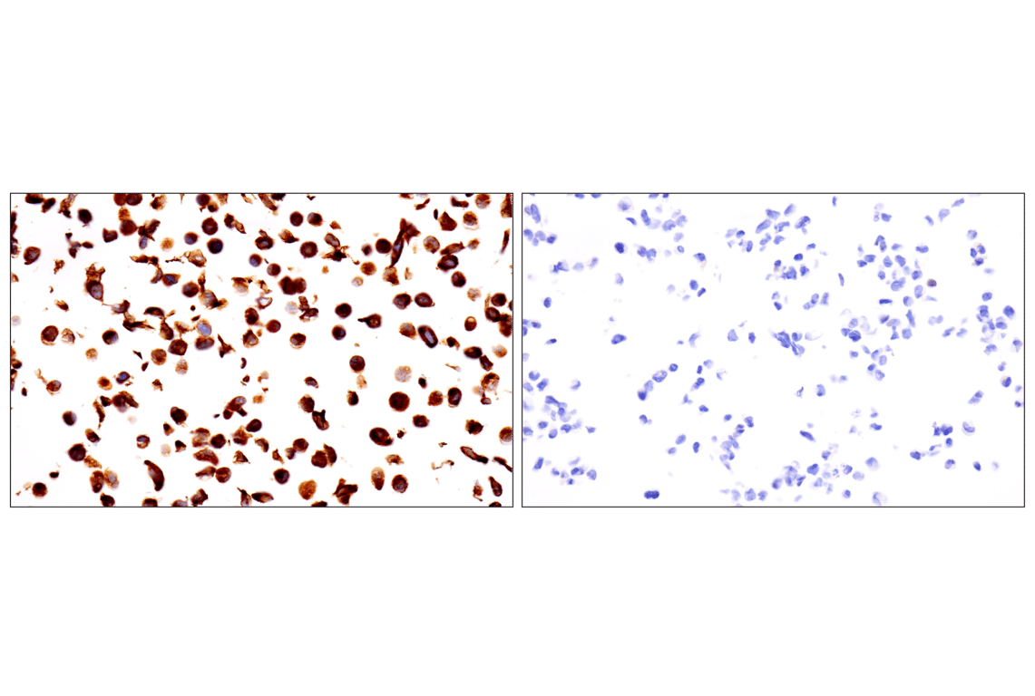 Immunohistochemistry Image 17: Desmin (F5V4I) Rabbit Monoclonal Antibody (BSA and Azide Free)