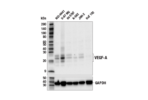 undefined Image 18: Cancer-associated Growth Factor Antibody Sampler Kit