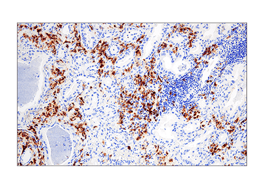 Immunohistochemistry Image 1: CRACC/SLAMF7/CD319 (E5C4M) Rabbit Monoclonal Antibody