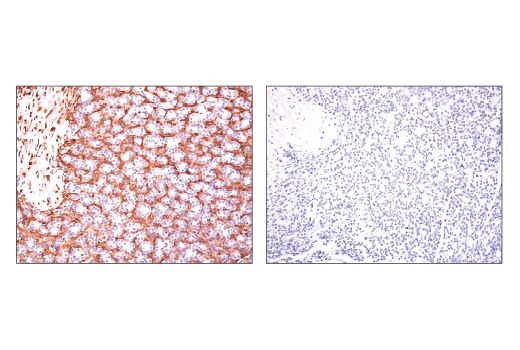 Immunohistochemistry Image 1: CRMP-2 (D8L6V) Rabbit Monoclonal Antibody