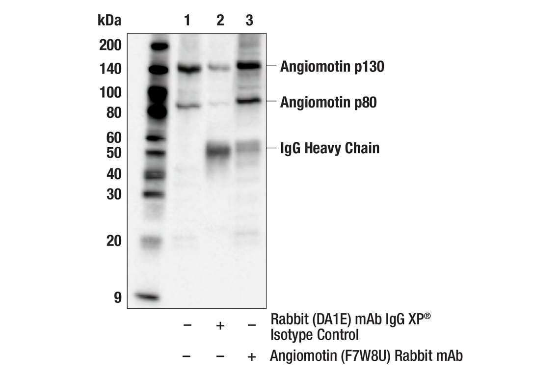 Immunoprecipitation Image 1: Angiomotin (F7W8U) Rabbit Monoclonal Antibody