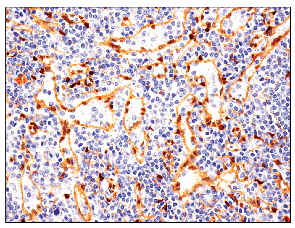 Immunohistochemistry Image 1: YAP (D8H1X) Rabbit Monoclonal Antibody