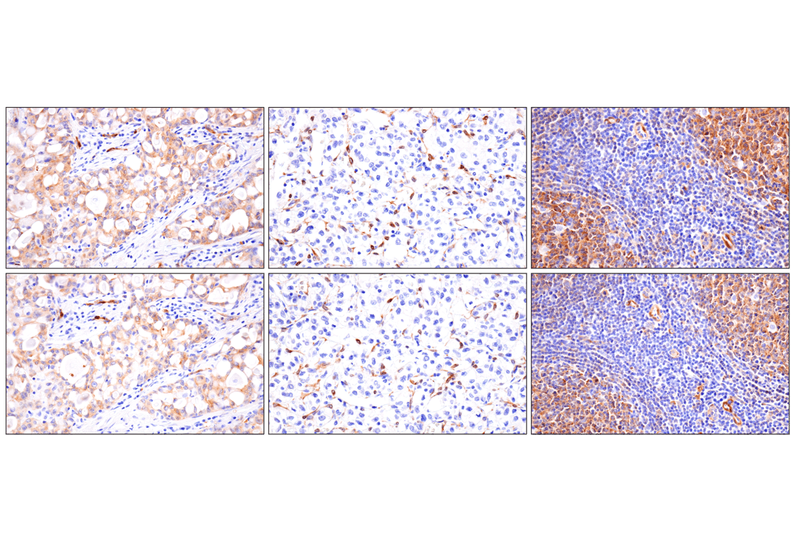 Immunohistochemistry Image 10: FAK (F7Z4C) Mouse Monoclonal Antibody (BSA and Azide Free)
