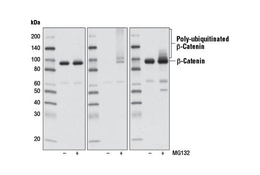 Western Blotting Image 3: Non-phospho (Active) beta-Catenin (Ser33/37/Thr41) (D13A1) Rabbit Monoclonal Antibody