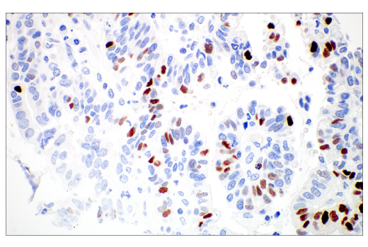 Immunohistochemistry Image 5: MAGE-C2/CT10 (E7B8D) Rabbit Monoclonal Antibody