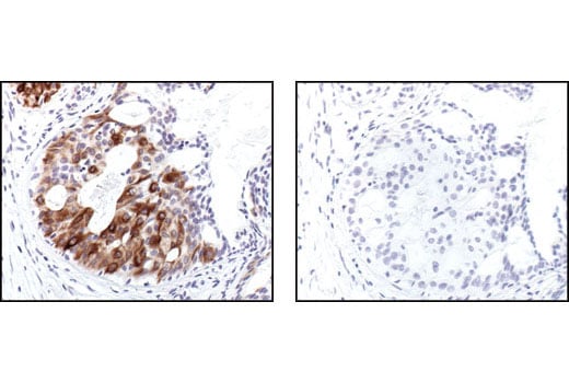 Immunohistochemistry Image 2: Phospho-NF-kappaB p105 (Ser932) (178F3) Rabbit Monoclonal Antibody (BSA and Azide Free)