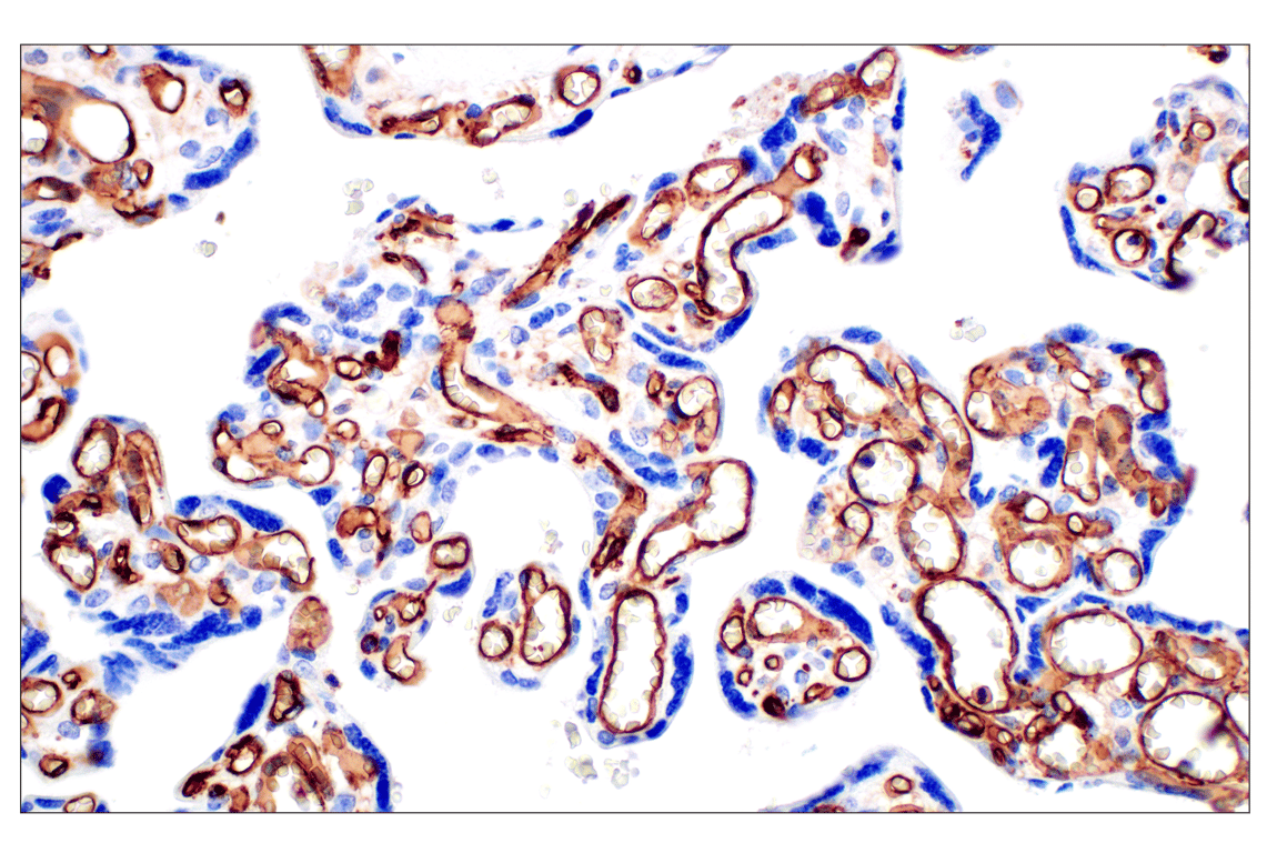 Immunohistochemistry Image 12: CD31 (PECAM-1) (F8M3S) Rabbit Monoclonal Antibody