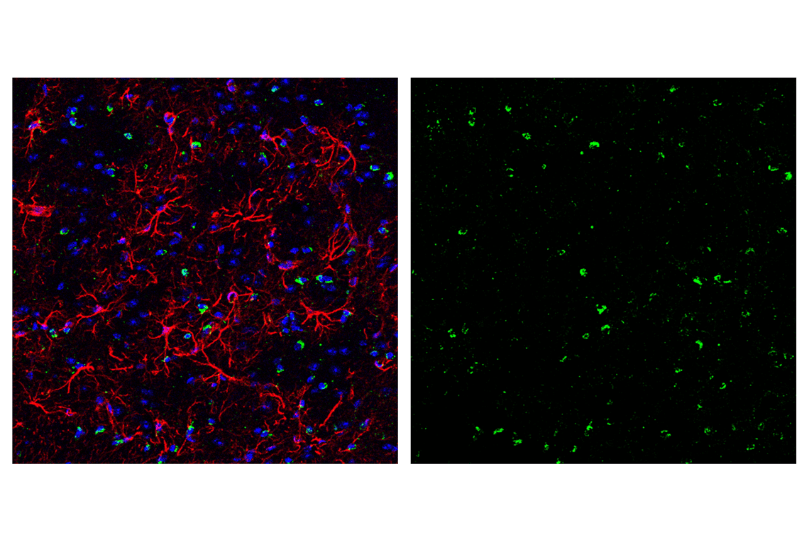 Immunofluorescence Image 6: Smac/Diablo (D5S3R) Rabbit Monoclonal Antibody