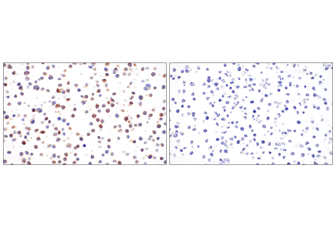 Immunohistochemistry Image 8: Perforin (IHC646) Mouse Monoclonal Antibody
