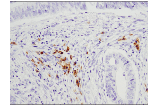 Immunohistochemistry Image 1: CD19 (Intracellular Domain) (D4V4B) Rabbit Monoclonal Antibody