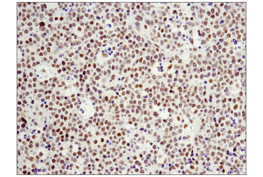 Immunohistochemistry Image 2: LRF/Pokemon (D7U2O) Rabbit Monoclonal Antibody (BSA and Azide Free)