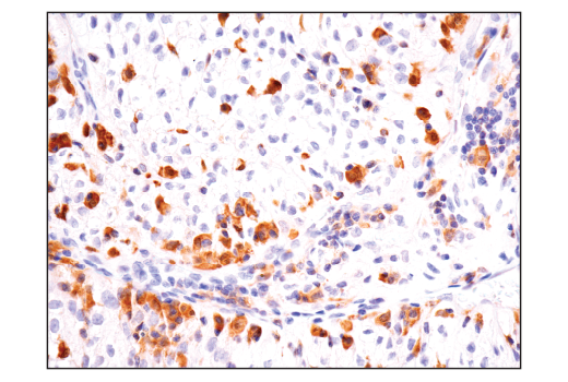 undefined Image 29: Human Reactive Inflammasome Antibody Sampler Kit II