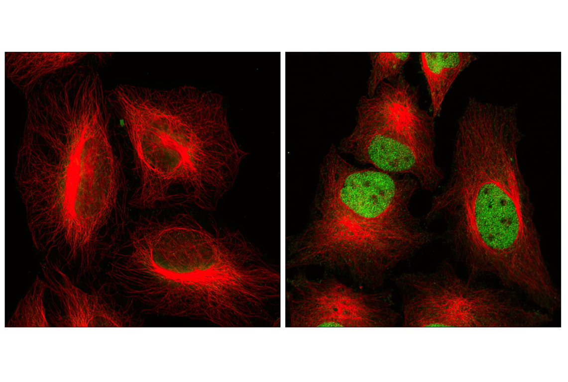 Immunofluorescence Image 1: Phospho-Stat3 (Tyr705) (M9C6) Mouse Monoclonal Antibody