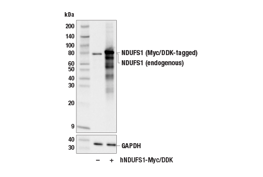 undefined Image 22: Electron Transport Chain (Complex I, III, IV) Antibody Sampler Kit