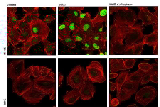 Immunofluorescence Image 1: Phospho-Cyclin D1 (Thr286) (D29B3) Rabbit Monoclonal Antibody (BSA and Azide Free)
