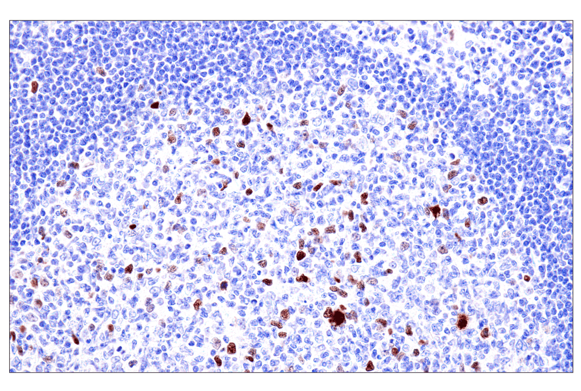 Immunohistochemistry Image 6: Phospho-NPM1 (Thr199) (E4C7S) Rabbit Monoclonal Antibody