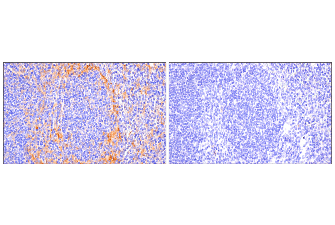 Immunohistochemistry Image 9: FAK (F7Z4C) Mouse Monoclonal Antibody