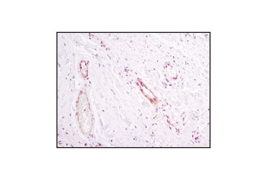 Immunohistochemistry Image 1: Notch1 (D1E11) Rabbit Monoclonal Antibody