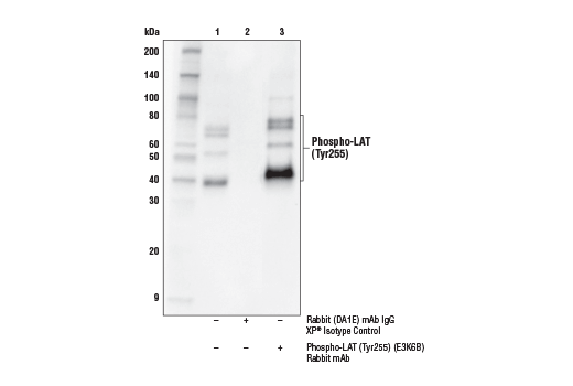Immunoprecipitation Image 1: Phospho-LAT (Tyr255) (E3K6B) Rabbit Monoclonal Antibody