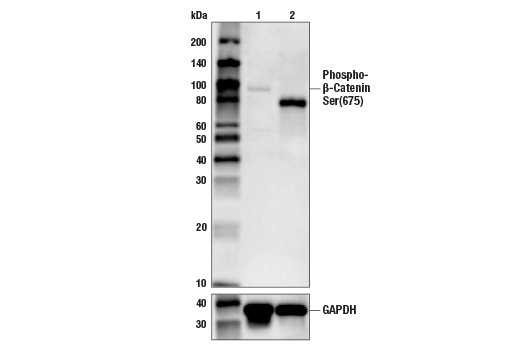 Western Blotting Image 1: Phospho-β-Catenin (Ser675) (D2F1) XP<sup>®</sup> Rabbit mAb