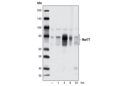 Western Blotting Image 2: Nur77 (D63C5) Rabbit Monoclonal Antibody