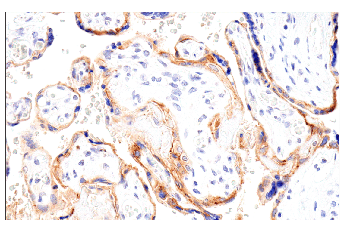 Immunohistochemistry Image 5: Folate Receptor Alpha/FOLR1 (BN3.2) Mouse Monoclonal Antibody