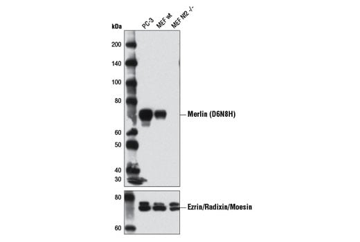 Western Blotting Image 2: Merlin (D6N8H) Rabbit Monoclonal Antibody